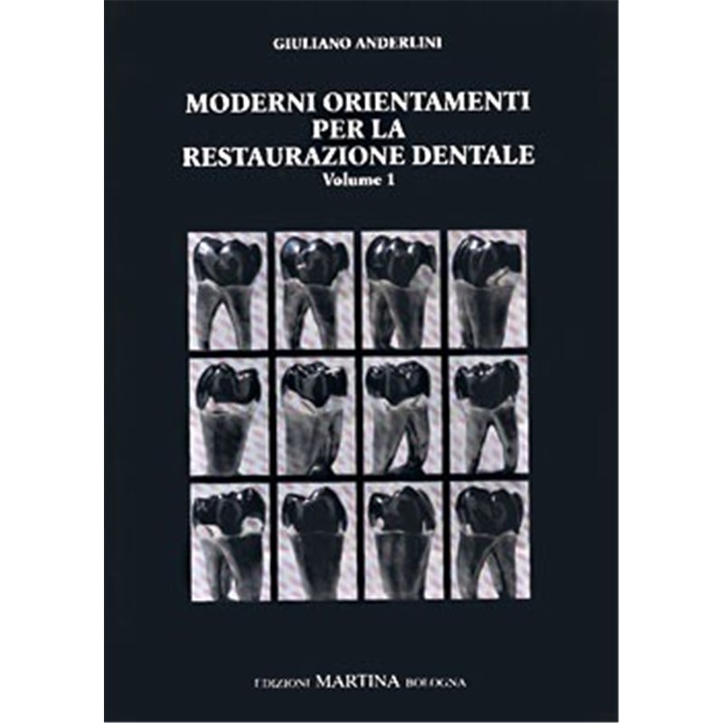 Moderni orientamenti per la restaurazione dentale - Volume 1°